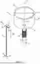 Fig. 02 - ELECTROMAGNETIC COLPOTOMY CUP SYSTEM