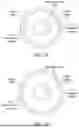 Fig. 09 - INTRAVASCULAR LITHOTRIPSY