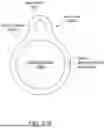 Fig. 45 - INTRAVASCULAR LITHOTRIPSY