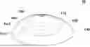 Fig. 01 - BREAST IMPLANT AND MANUFACTURING METHOD FOR SAME