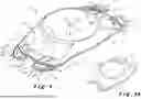 Fig. 02 - POSTERIOR CHAMBER PHAKIC INTRAOCULAR LENS (IOL) AND MANUFACTURING METHOD OF THE SAME