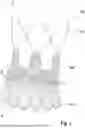 Fig. 02 - AORTIC BIOPROSTHESIS AND SYSTEMS FOR DELIVERY THEREOF