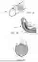 Fig. 02 - SEQUENTIAL PENILE ELONGATION AND ANGULAR REALIGNMENT SYSTEM