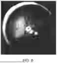 Fig. 09 - SURGICAL TOOL AND METHOD FOR SOFT OCULAR TISSUE TRANSPLANTATION