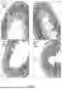Fig. 16 - METHODS FOR TREATMENT OR PREVENTION OF DAMAGE RESULTING FROM RADIATION, TRAUMA OR SHOCK