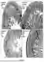 Fig. 25 - METHODS FOR TREATMENT OR PREVENTION OF DAMAGE RESULTING FROM RADIATION, TRAUMA OR SHOCK