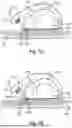 Fig. 11 - APPLICATOR DEVICE FOR INSULIN PATCH PUMP WITH CANNULA DEPTH CONTROL