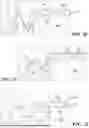 Fig. 06 - TOOLING AND METHODS FOR FORMING A COMPONENT WITH AN OVERMOLD LAYER