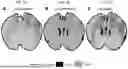 Fig. 02 - FC-Containing Compositions And Methods For Increasing Transport Into The Brain
