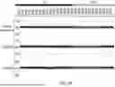 Fig. 09 - ANTI-THYMOCYTE GLOBULIN COMPOSITIONS AND METHODS