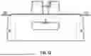 Fig. 35 - SYSTEMS AND DEVICES FOR WOUND THERAPY AND RELATED METHODS OF USE