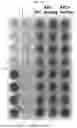 Fig. 06 - CULTIVATION METHOD FOR ENHANCING DIFFERENTIATION EFFICIENCY AND FUNCTIONALITY OF NK CELLS