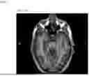 Fig. 08 - METHODS AND COMPOSITIONS FOR TREATING EPILEPSY