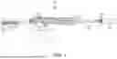 Fig. 02 - DIVERGING CENTRAL BORE FOR FIREARM SOUND SUPPRESSOR