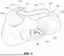 Fig. 03 - SLING MOUNT