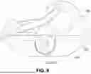 Fig. 10 - SLING MOUNT