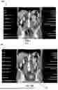 Fig. 07 - SYSTEM AND METHOD FOR AUTOMATED DEVELOPMENT OF MEDICAL DIAGNOSTIC SOFTWARE USING MACHINE LEARNING AND ARTIFICIAL INTELLIGENCE