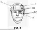 Fig. 04 - DIGITAL ENHANCED VISION SYSTEM WITH AUGMENTED REALITY DISPLAY
