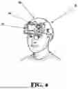 Fig. 05 - DIGITAL ENHANCED VISION SYSTEM WITH AUGMENTED REALITY DISPLAY