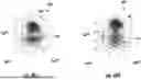 Fig. 45 - IMAGE CHANGE DETECTION DEVICE UTILIZING QUANTUM MACHINE LEARNING AND RELATED METHODS