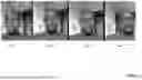 Fig. 04 - METHODS AND SYSTEMS FOR DETECTING FRAUD DURING BIOMETRIC IDENTITY VERIFICATION