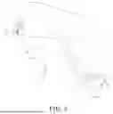 Fig. 06 - SINGLE-HAND OPERATED TRIGGER DEVICE