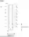 Fig. 06 - STATOR