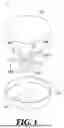 Fig. 02 - Filter Structure