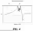 Fig. 04 - Filter Structure