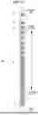 Fig. 13 - ENDOSCOPIC ARTICULATING TUBE