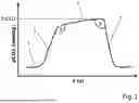 Fig. 02 - METHOD AND APPARATUS FOR DETERMINING ARTERIAL CO2 CONCENTRATION