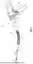 Fig. 02 - ADAPTER ASSEMBLY WITH CONSTANT VELOCITY JOINTS