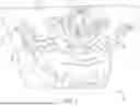 Fig. 02 - SURGICAL CUTTING GUIDES DESIGNED FOR ANATOMICAL LANDMARKS