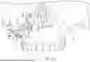 Fig. 03 - SURGICAL CUTTING GUIDES DESIGNED FOR ANATOMICAL LANDMARKS