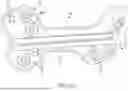 Fig. 04 - SURGICAL CUTTING GUIDES DESIGNED FOR ANATOMICAL LANDMARKS