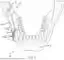 Fig. 06 - SURGICAL CUTTING GUIDES DESIGNED FOR ANATOMICAL LANDMARKS