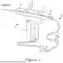 Fig. 02 - INTRAVASCULAR LITHOTRIPSY DEVICES WITH THIN-WALLED BALLOONS AND SYSTEMS