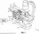 Fig. 02 - SYSTEM AND METHOD TO MEASURE UTERINE WALL THICKNESS