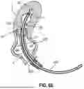 Fig. 09 - SYSTEM AND METHOD TO MEASURE UTERINE WALL THICKNESS