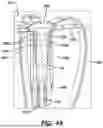 Fig. 05 - ELECTROPHYSIOLOGY CATHETER SYSTEM WITH COMPOSITE ELECTRODE BASED ON CONTACT FORCE AND IMPEDANCE SENSING FOR IRREVERSIBLE-ELECTROPORATION (IRE) AND RELATED METHODS