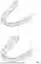 Fig. 02 - ALIGNER MADE BY JOINING EDGEWISE INDIVIDUAL POLYMER PIECES