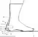 Fig. 01 - CAST PRESSURE RELIEVING SYSTEM
