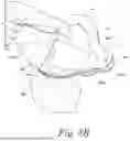 Fig. 09 - Fecal Collection Systems and Methods