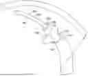 Fig. 01 - METHODS AND DEVICES FOR INCREASING AQUEOUS DRAINAGE OF THE EYE