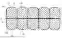 Fig. 01 - Cell Bladder, Expandable Bladder, Port System and Attachment System