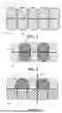 Fig. 03 - Cell Bladder, Expandable Bladder, Port System and Attachment System