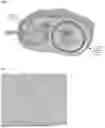 Fig. 02 - TREATING DISEASES AND DISORDERS WITH IRAK4-MODIFYING COMPOUNDS