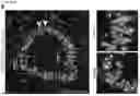 Fig. 49 - Methods for Treating Respiratory Diseases Characterized by Mucus Hypersecretion