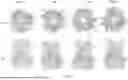 Fig. 07 - METHOD OF REDUCING ADENOVIRAL VECTOR-ASSOCIATED TTS