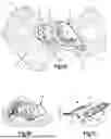 Fig. 02 - BENDABLE TITANIUM-ALLOY IMPLANTS, AND RELATED SYSTEMS AND METHODS